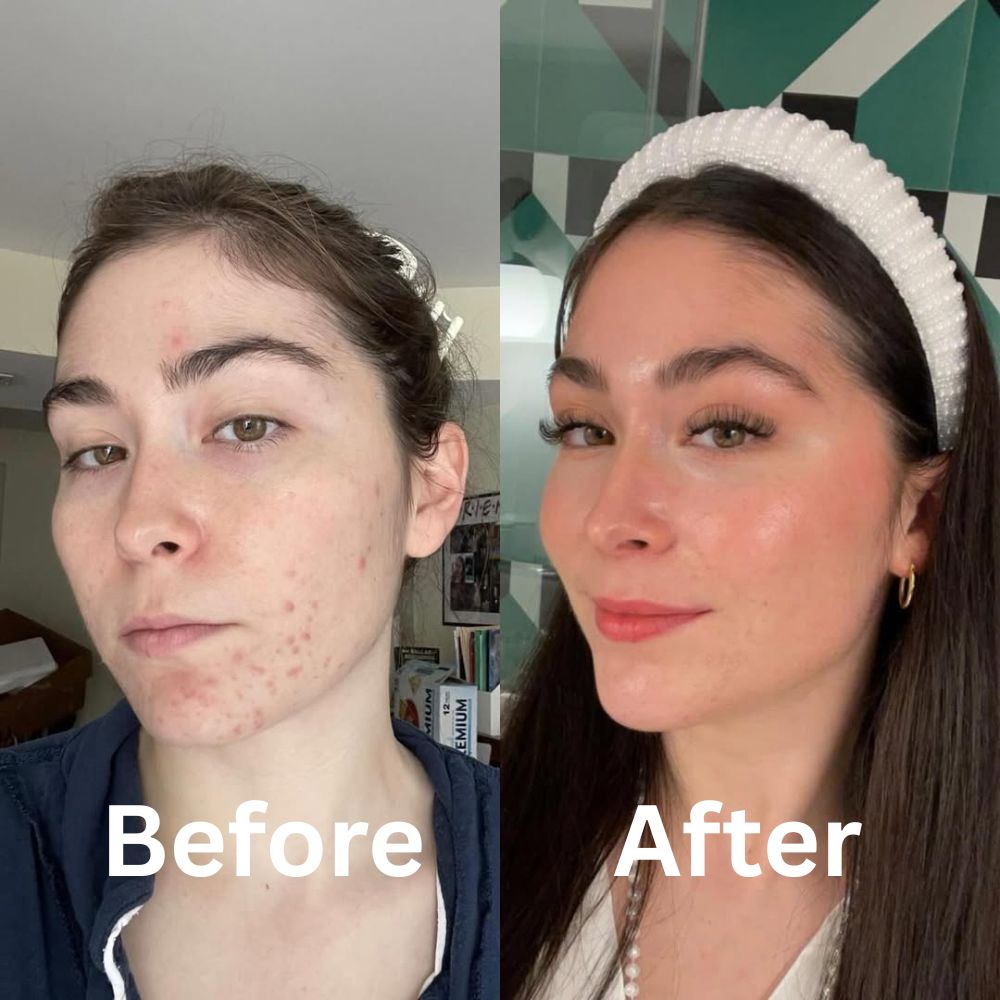 Before and after